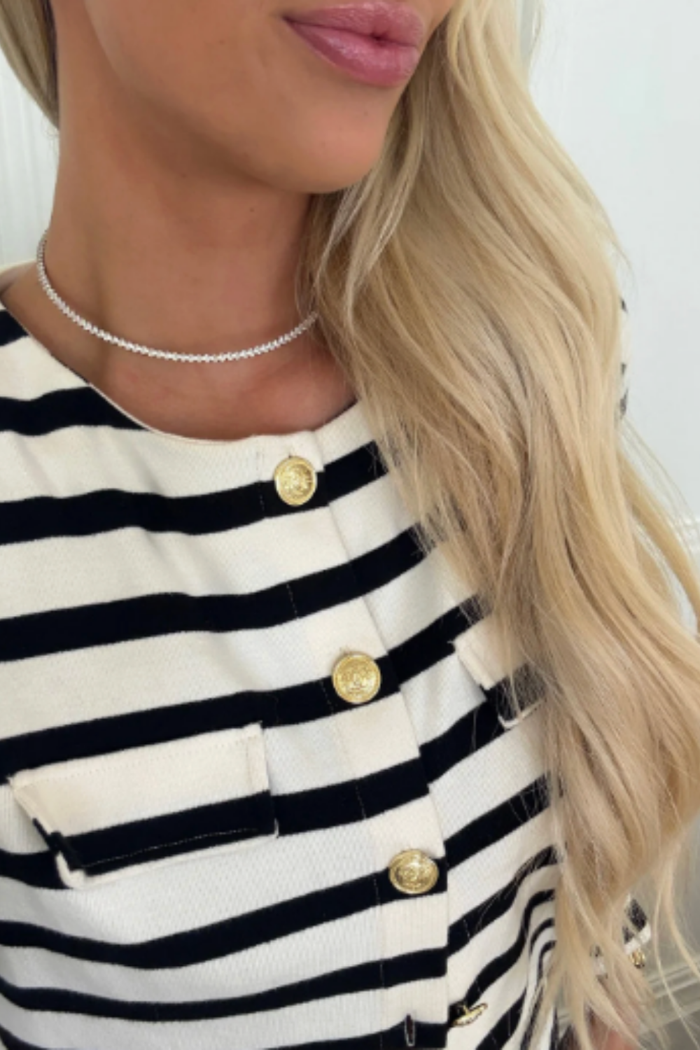 Close-up of a person wearing a black and white striped shirt with gold buttons.